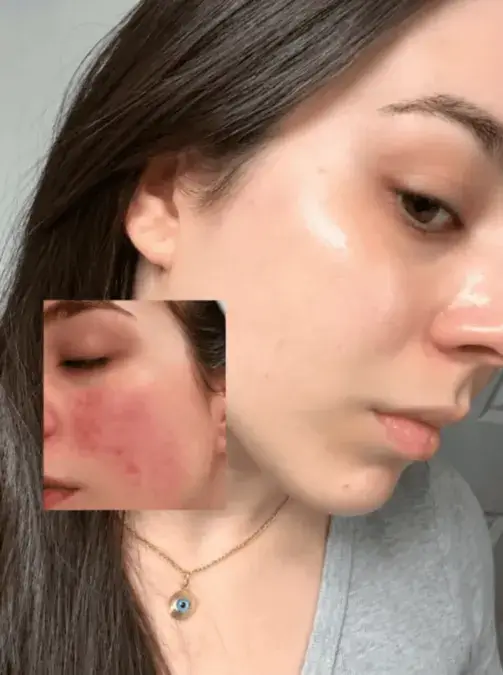 Antes e depois enviado por Carla M.