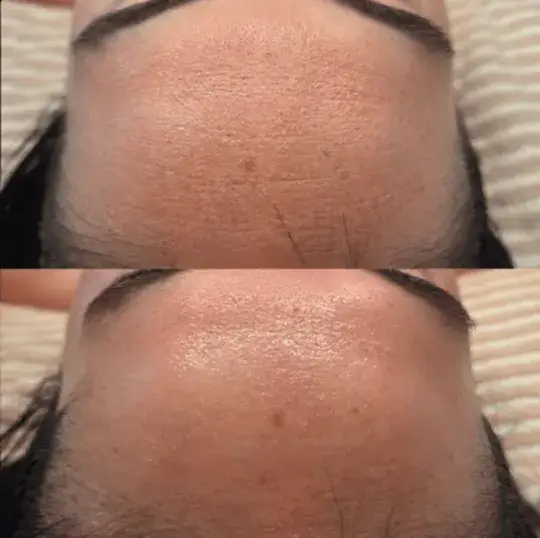 Antes e depois enviado por Júlia P.