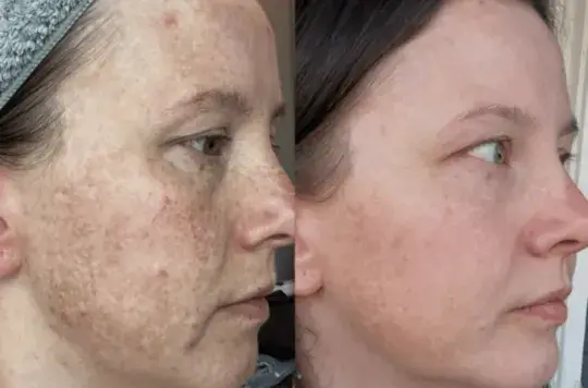 Antes e depois enviado por Mariana L.