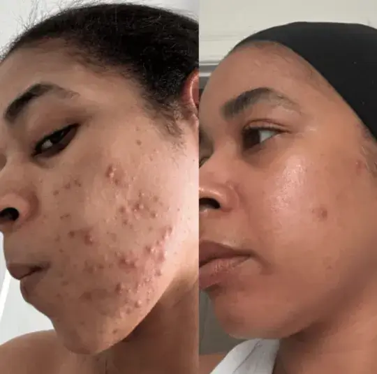 Antes e depois enviado por Renata B.